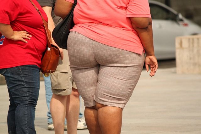 Veľmi obézny žena v kraťasoch